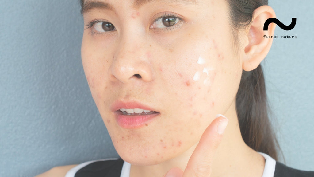 Repair Skin Barrier: How to Restore Healthy and Hydrated Skin